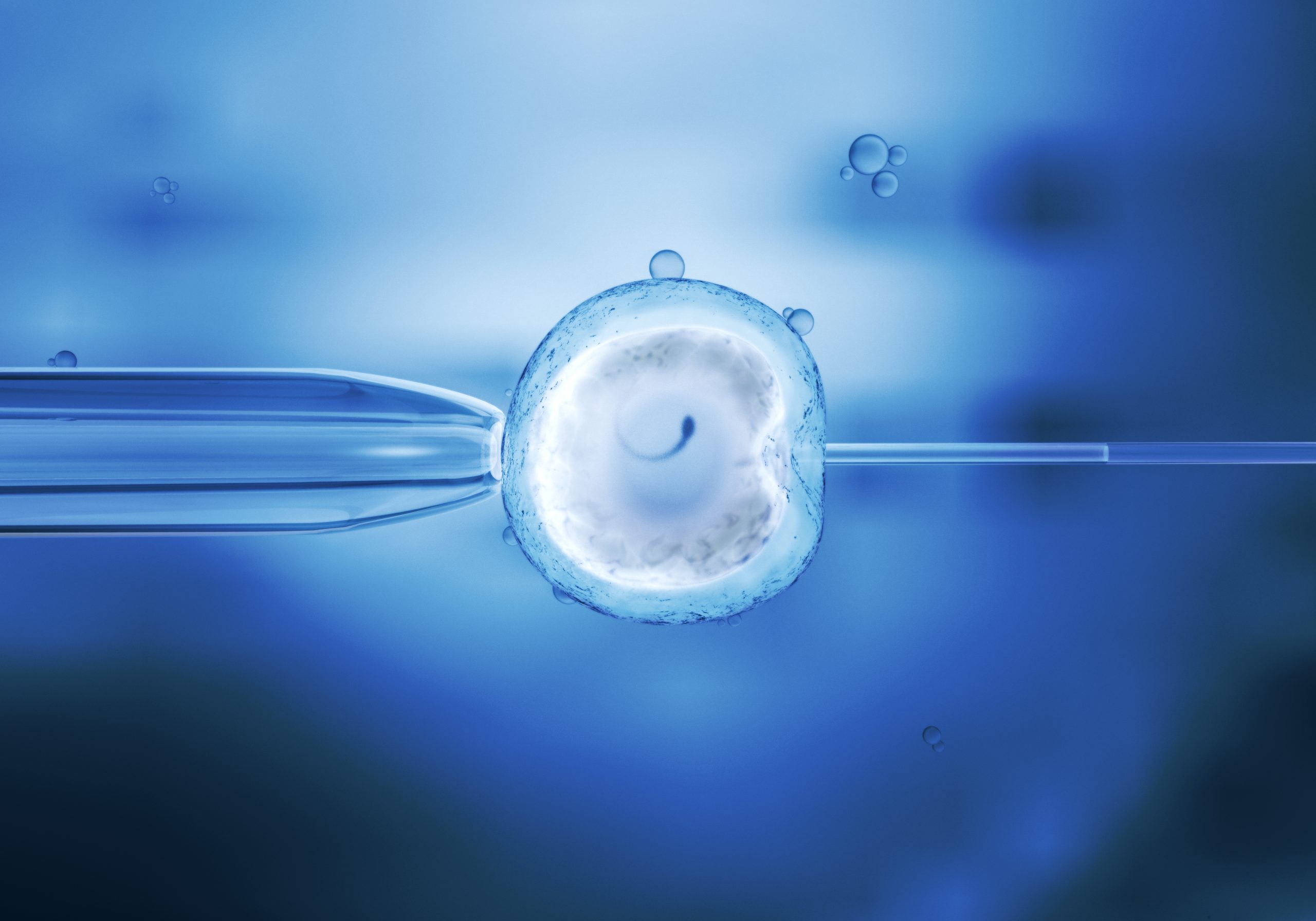 Current Stage of In Vitro Fertilization (IVF) Treatment